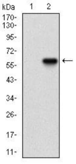 Ku70/XRCC6 Antibody (2F7F5) - BSA Free, Novus Biologicals:Antibodies:Primary